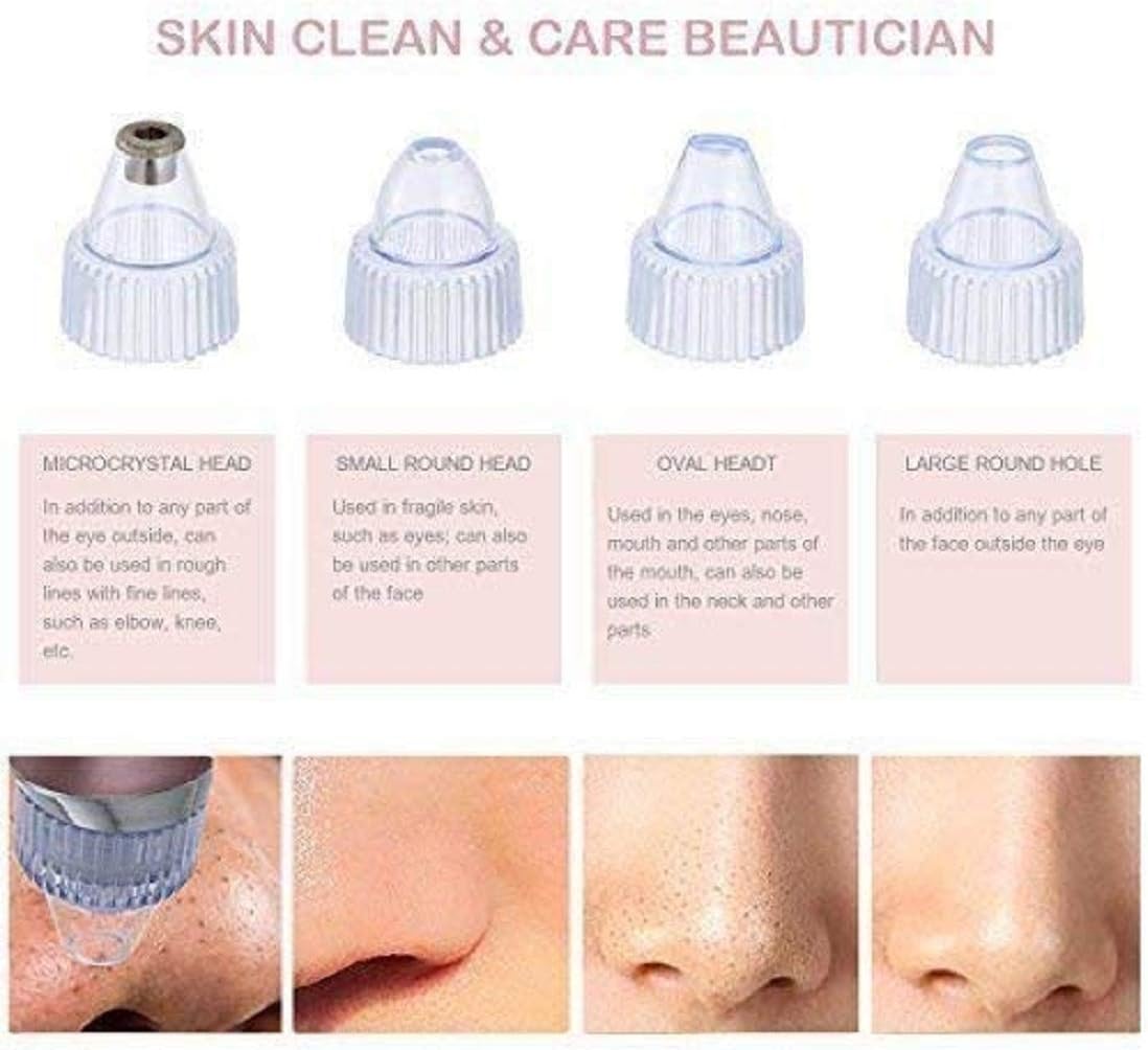 Dermasuction Pore Cleaning Device